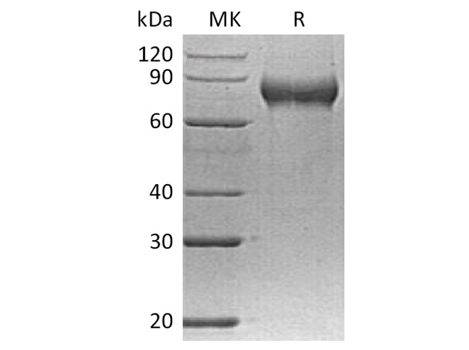 Recombinant Human FLRT2 Protein (His Tag)