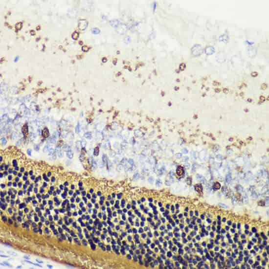Immunohistochemistry of paraffin-embedded Rat retina using RCVRN Polyclonal Antibody at dilution of 1:200 (40x lens).