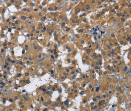 CD160 Polyclonal Antibody - 2