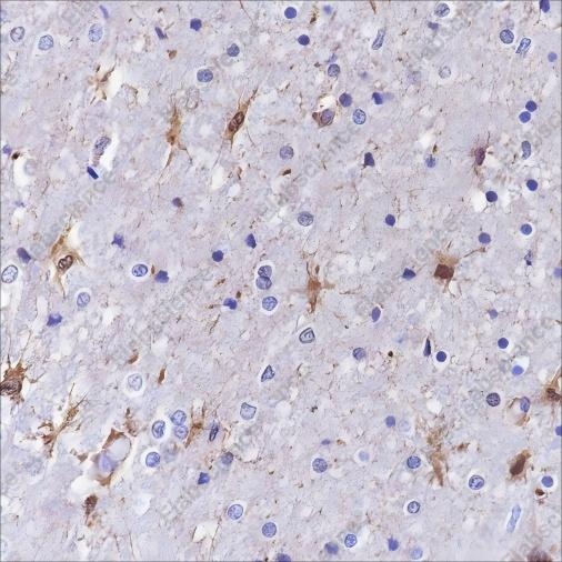 Recombinant S100A13 Monoclonal Antibody - 1