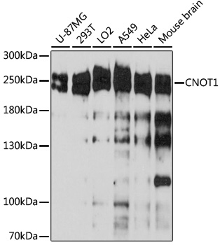 Western blot analysis of extracts of various cell line using CNOT1 Polyclonal Antibody at 1:3000 dilution.