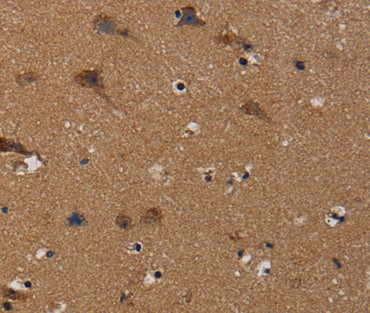 Immunohistochemistry of paraffin-embedded Human brain using TP53INP1 Polyclonal Antibody at dilution of 1:50