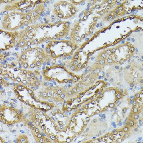 Immunohistochemistry of paraffin-embedded Rat kidney using DAPK3 Polyclonal Antibody at dilution of 1:100 (40x lens).