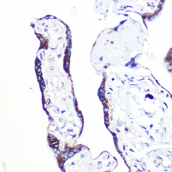 Immunohistochemistry of paraffin-embedded human placenta using PEX2 Polyclonal Antibody at dilution of 1:100 (40x lens).Perform high pressure antigen retrieval with 10 mM citrate buffer pH 6.0 before commencing with IHC staining protocol.