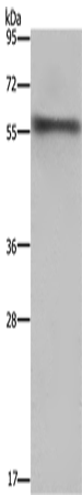 Western Blot analysis of Mouse heart tissue using FKBP8 Polyclonal Antibody at dilution of 1:1000