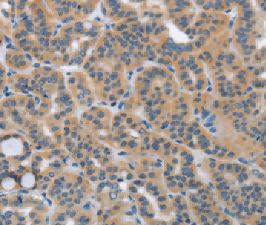 HSD3B1 Polyclonal Antibody - 2