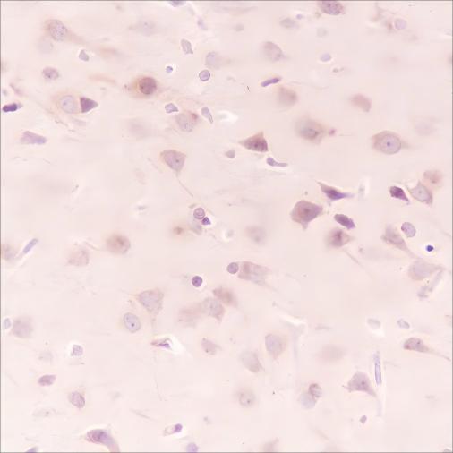 Recombinant HSP90 beta Monoclonal Antibody - small - 4