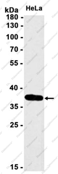 Recombinant MLD Monoclonal Antibody - 1