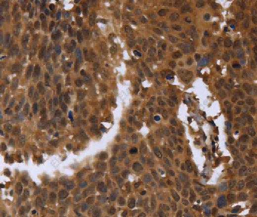 FGFRL1 Polyclonal Antibody - 3