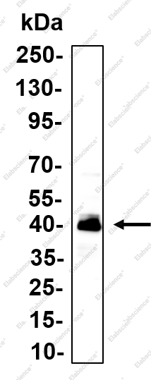 Recombinant ERCC1 Monoclonal Antibody - 1