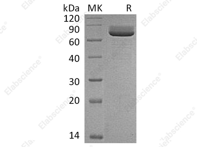 Recombinant Rat CD73/NT5E Protein (His Tag) - 1