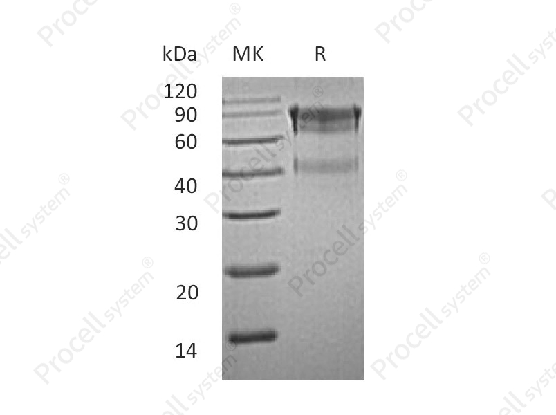 IL-15RA/CD215 (C-Fc), Mouse, Recombinant