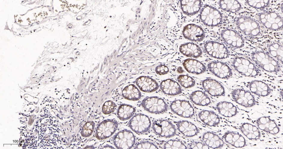 Recombinant CDK6 (PT0069R) Monoclonal Antibody - small - 2
