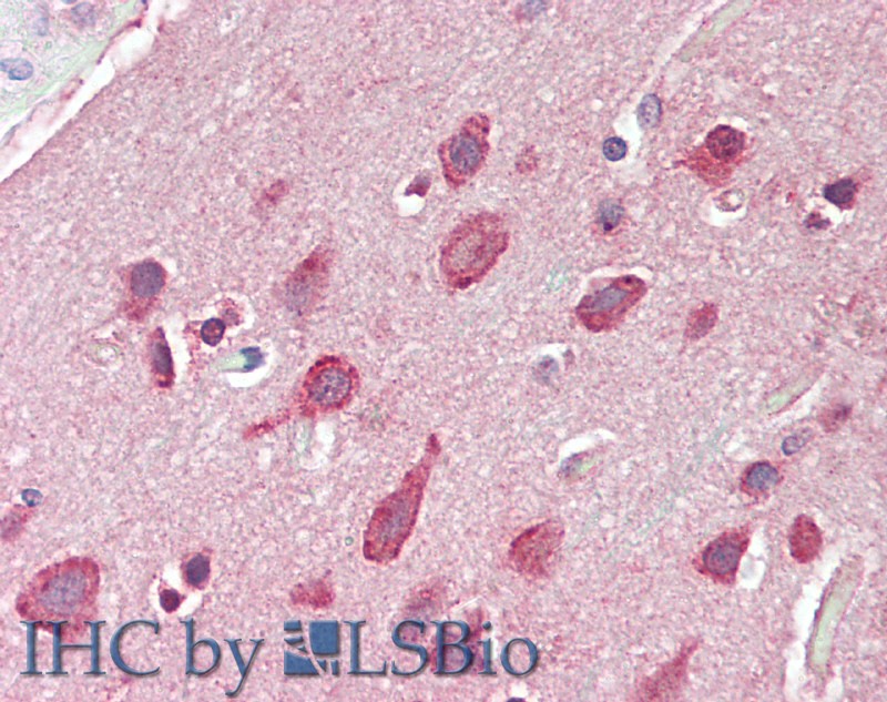 Immunohistochemistry of paraffin-embedded Brain, Cortex tissue using GRIN2C Polyclonal Antibody at dilution of 1:60(Elabscience Product Detected by Lifespan).