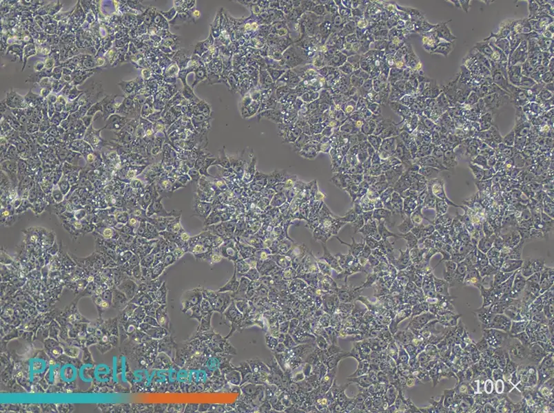 HuH-6 (DMEM) Cell Complete Medium - 2