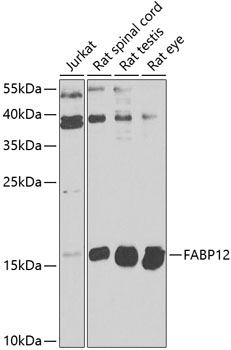 Western blot analysis of extracts of various cell lines using FABP12 Polyclonal Antibody at 1:1000 dilution.