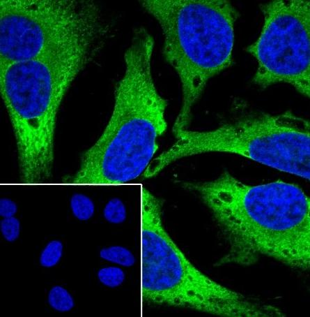 Recombinant DDX3 Monoclonal Antibody - small - 4