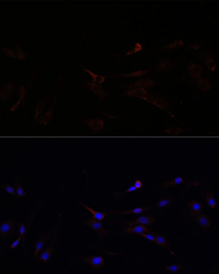 Immunofluorescence analysis of C6 cells using SUCLG1 Polyclonal Antibody at dilution of  1:100. Blue: DAPI for nuclear staining.