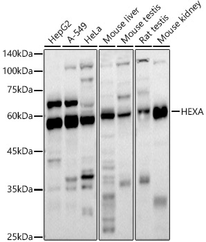 Western blot analysis of extracts of various cell lines using HEXA Polyclonal Antibody at 1:1000 dilution.