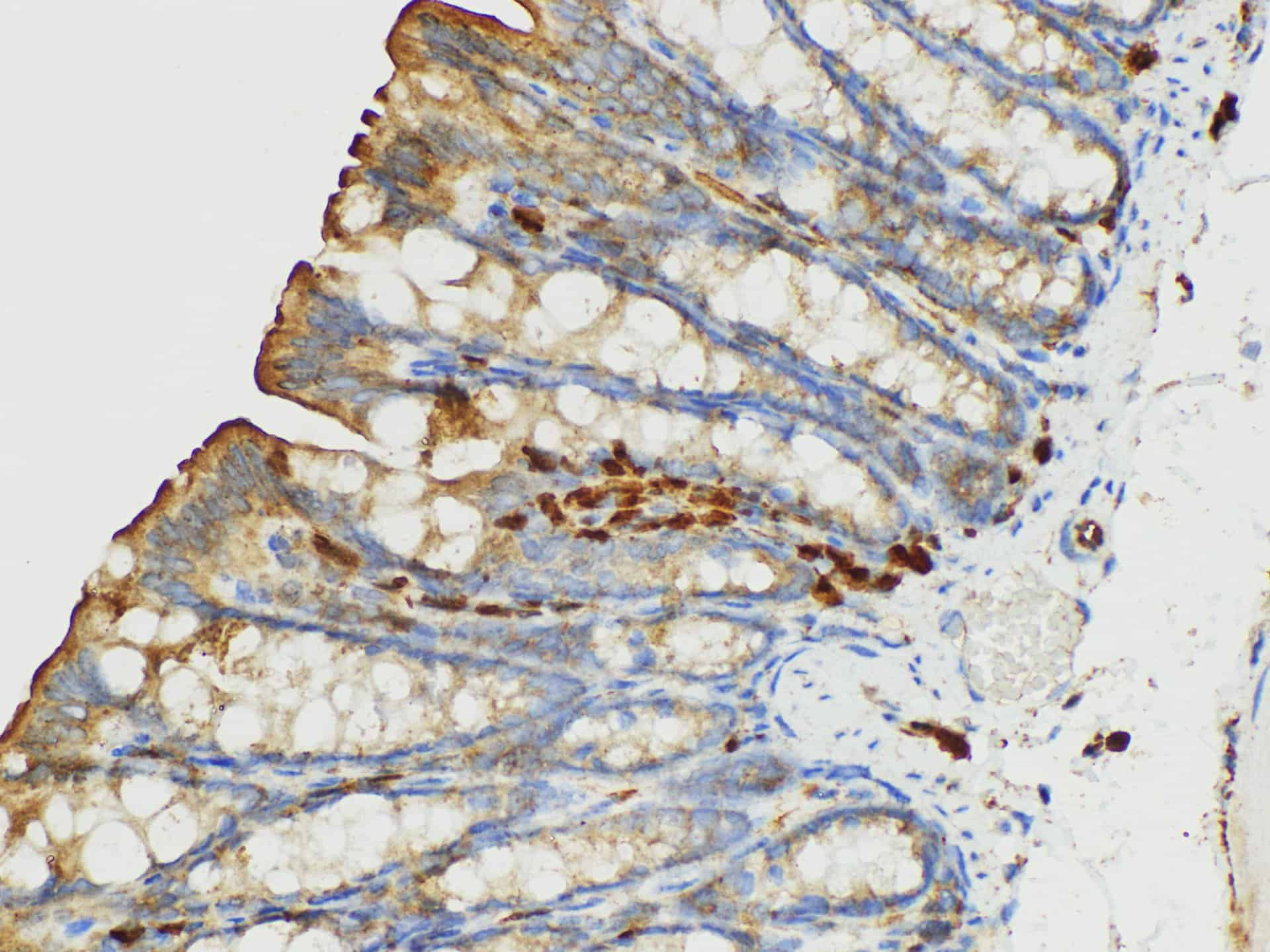 Immunohistochemistry of paraffin-embedded Mouse colon using S100A4 Polycloanl Antibody at dilution of 1:50.