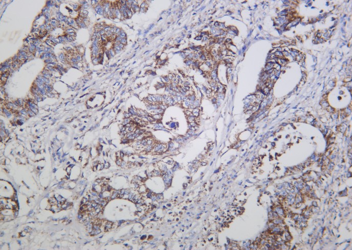Recombinant Cleaved Caspase-3 (Asp175) Monoclonal Antibody - small - 2