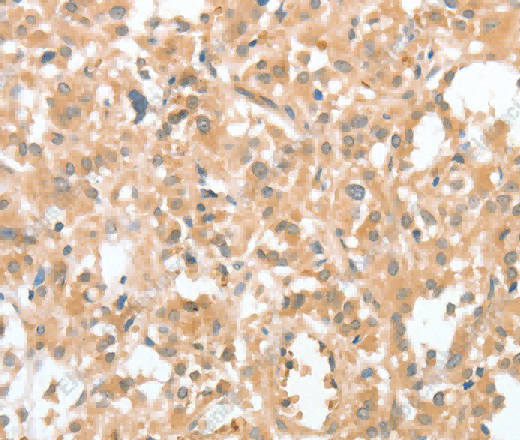 CIAPIN1 Polyclonal Antibody - 2