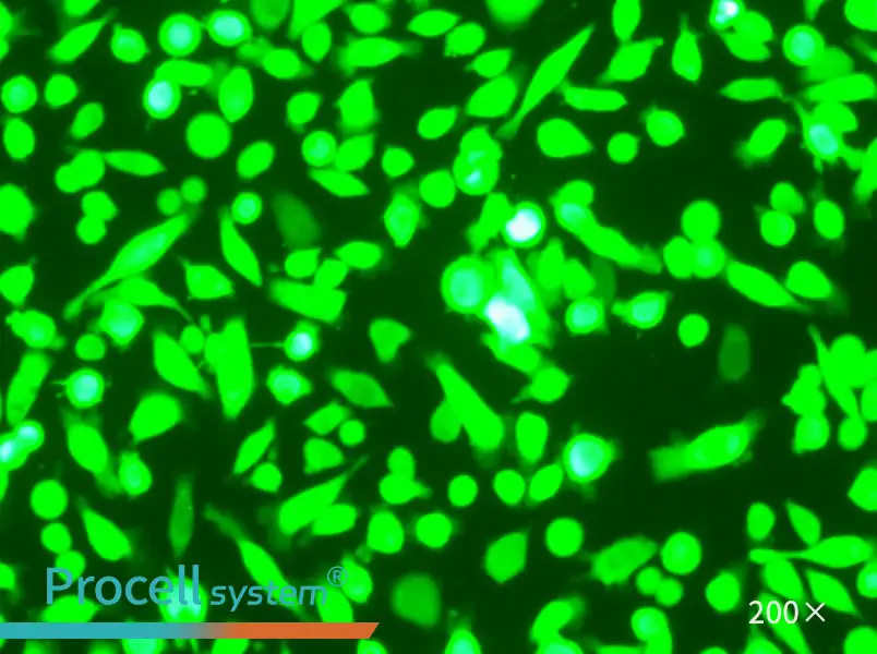 AGS-GFP Cell Complete Medium - 6