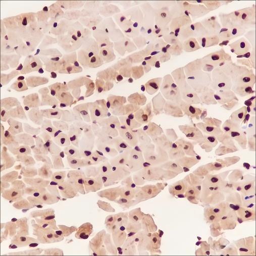 Recombinant COPS3 Monoclonal Antibody - 3