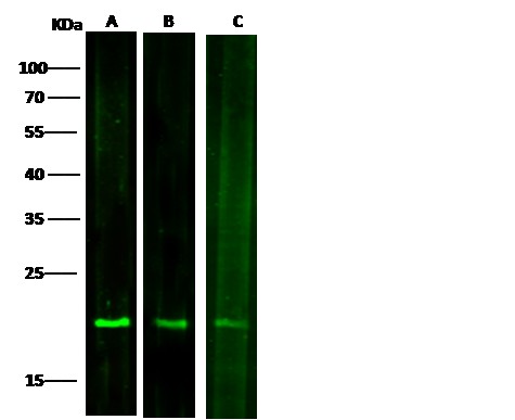 SOD1/Superoxide Dismutase Monoclonal Antibody - small - 3
