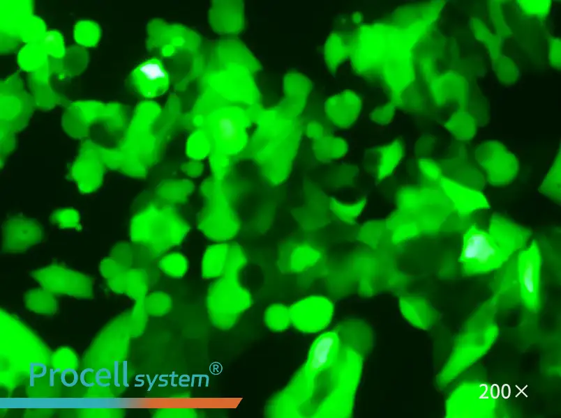 MCF7-LUC-EGFP Cell Complete Medium - small - 6