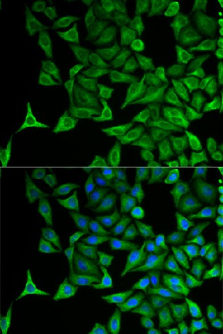 Immunofluorescence analysis of HeLa cells using KRT20 Polyclonal Antibody