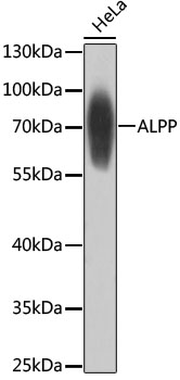 Western blot analysis of extracts of HeLa cells using ALPP Polyclonal Antibody at dilution of 1:1000.