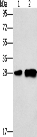 Western Blot analysis of Mouse liver tissue and 231 cell using LY96 Polyclonal Antibody at dilution of 1:500