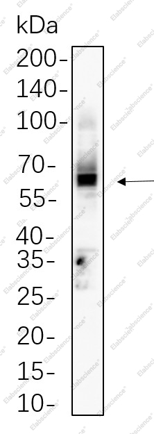 Recombinant CD4 Monoclonal Antibody - 1