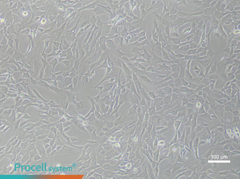 Mouse Aortic Smooth Muscle (Primary cell immortalization) Cell Complete MediumMouse Aortic Smooth Muscle (Primary cell immortalization) Cell Complete Medium - 1