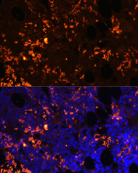 Immunofluorescence analysis of Rat bone marrow cells using GPR55 Polyclonal Antibody at dilution of  1:100. Blue: DAPI for nuclear staining.