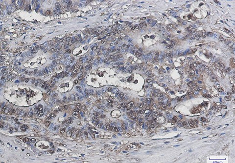 Recombinant Galectin 3 Monoclonal Antibody - 3