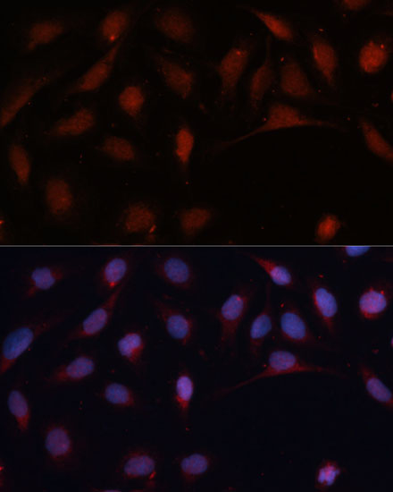 Immunofluorescence analysis of U-2 OS cells using ASC / TMS1 Polyclonal Antibody at dilution of  1:100 (40x lens). Blue: DAPI for nuclear staining.