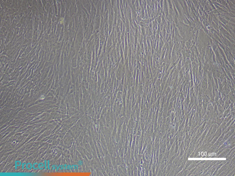 Human Cerebral Artery Smooth Muscle Cell Complete Medium - 1