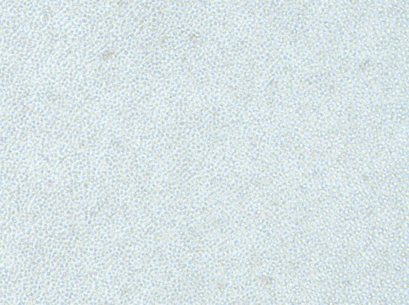 OCI-AML-2 Cell Complete Medium - 3