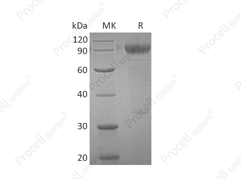 IL-3RA, Human, Recombinant
