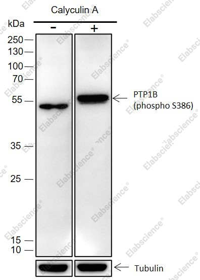 Recombinant Phospho-PTP1B (Ser386) Monoclonal Antibody - 1