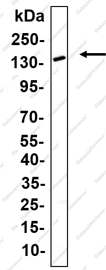 Recombinant Tyk 2 Monoclonal Antibody - 1