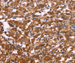 APMAP Polyclonal Antibody - 2