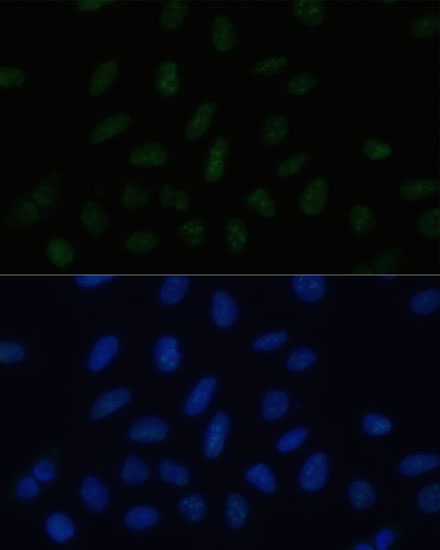 Immunofluorescence analysis of U-2 OS cells using PELP1 Polyclonal Antibody at dilution of  1:100 (40x lens). Blue: DAPI for nuclear staining.