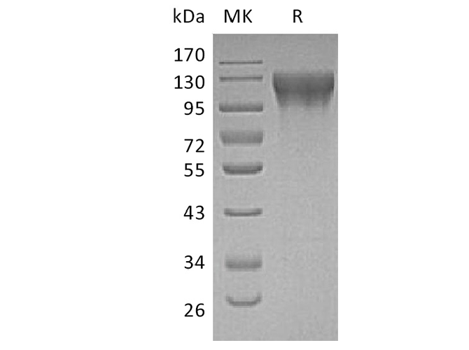 Recombinant Human ECE1 Protein (His Tag)