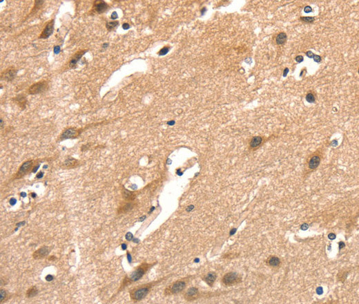 Immunohistochemistry of paraffin-embedded Human brain  using AIMP1 Polyclonal Antibody at dilution of 1:40