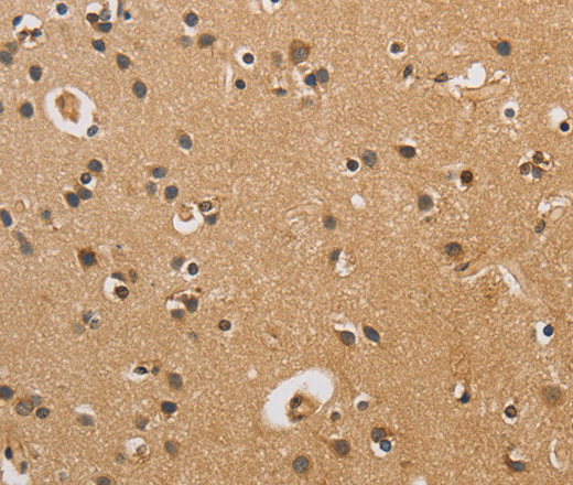 Immunohistochemistry of paraffin-embedded Human brain tissue using CST6 Polyclonal Antibody at dilution 1:70