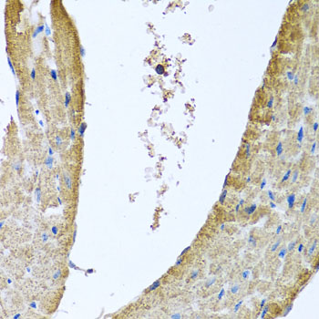 Immunohistochemistry of paraffin-embedded Mouse heart using COX5B Polyclonal Antibody at dilution of  1:100 (40x lens).