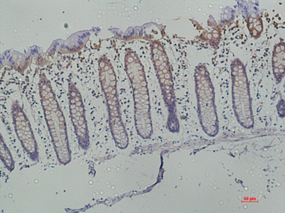 Immunohistochemistry of paraffin-embedded Human colon using Galectin 3 Monoclonal Antibody at dilution of 1:50.